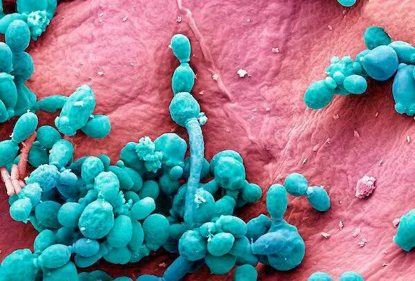 Candida spp микробиология. Грибы рода candida являются. Грибы рода кандида строение. Кандида альбиканс под микроскопом. Гриб кандида лечение.