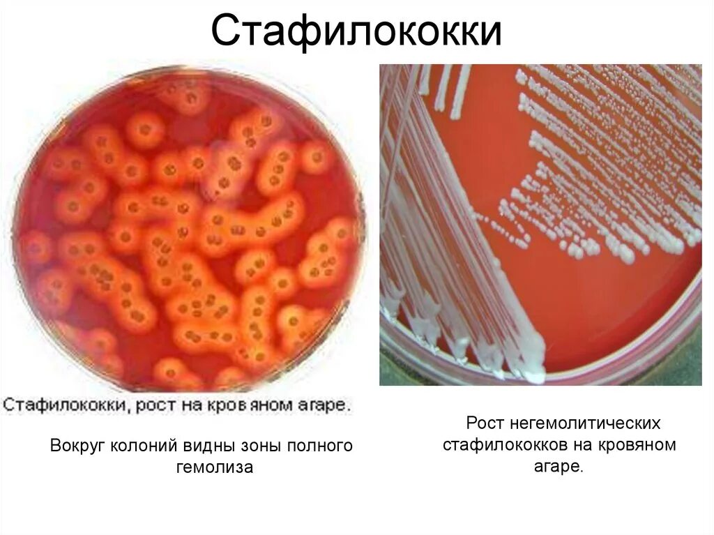 Рост стафилококка на кровяном агаре. На кровяном агаре колонии стафилококков кровяном. Гемолитический стафилококк. Staphylococcus aureus среда