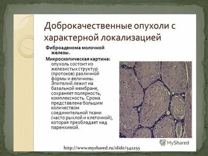 Доброкачественная ткань