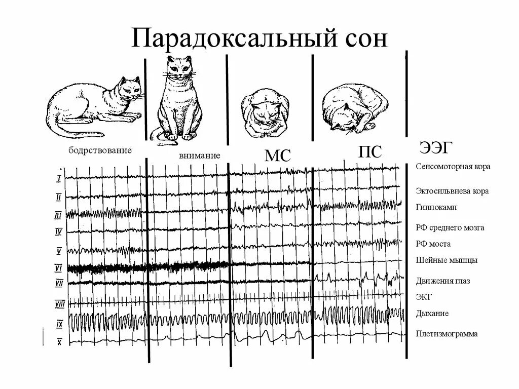 Схемы сна и бодрствования. ЭЭГ сна и бодрствования. Парадоксальная фаза сна характеризуется:. Цикл сон бодрствование.