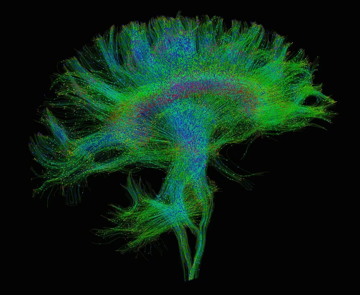 Diffusion tensor. Diffusion tensor imaging (dti). трактография. трактография головного мозга. трактография мрт.