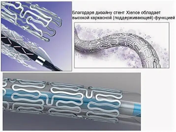 3 стента. Коронарный стент Калипсо. Boston Scientific стент. Стент Xience Xpedition. Biomatrix стент коронарный.