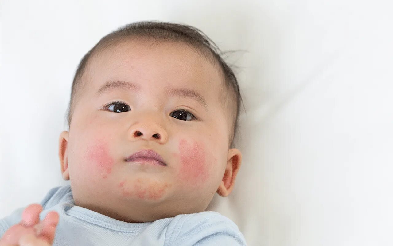 Why baby лицо. Грудной ребенок косметика. I skin baby. I skin baby. Baby skin для молодой кожи.