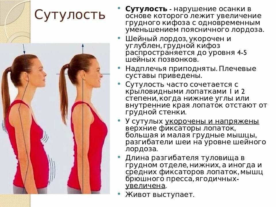 Под правильной осанкой понимается