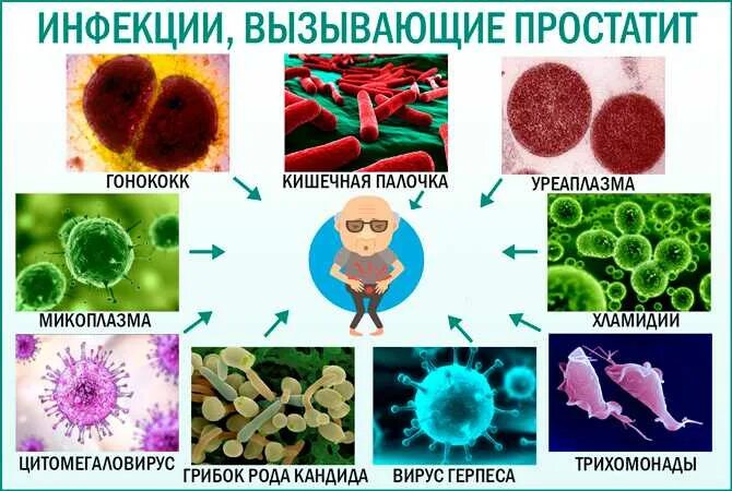 Хламидии трихомонады микоплазма. Половые инфекции бактериальные вирусные. Бактерии вызывающие простатит. Инфекции провоцирующие простатит. Инфекции вызванные кишечной палочкой.