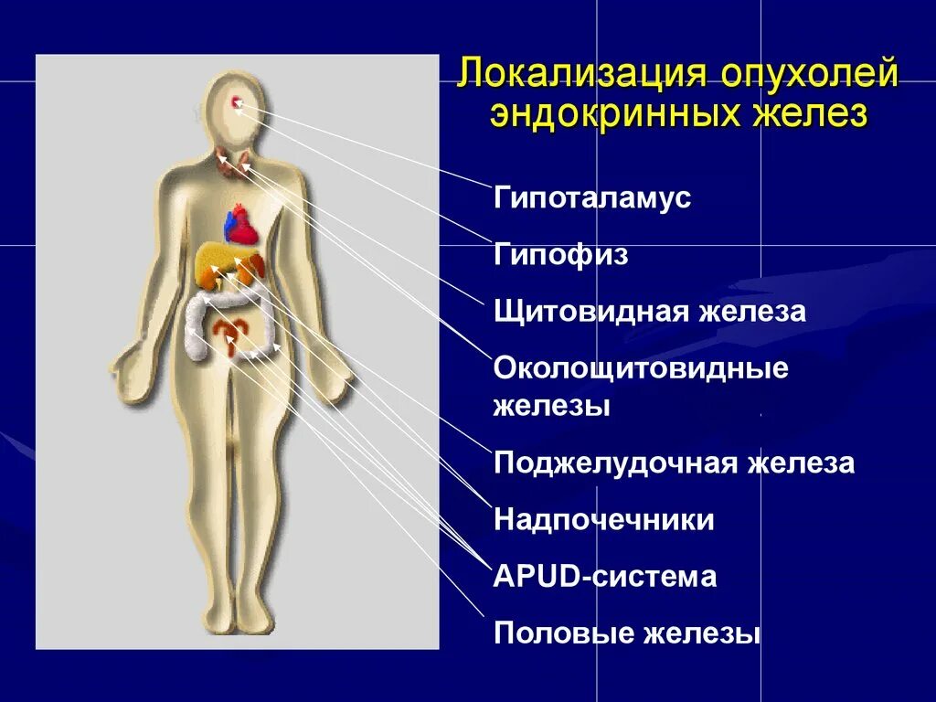 Опухоль эндокринных органов. Опухоли эндокринных желез. Локализация эндокринных желез. Заболевания эндокринных органов