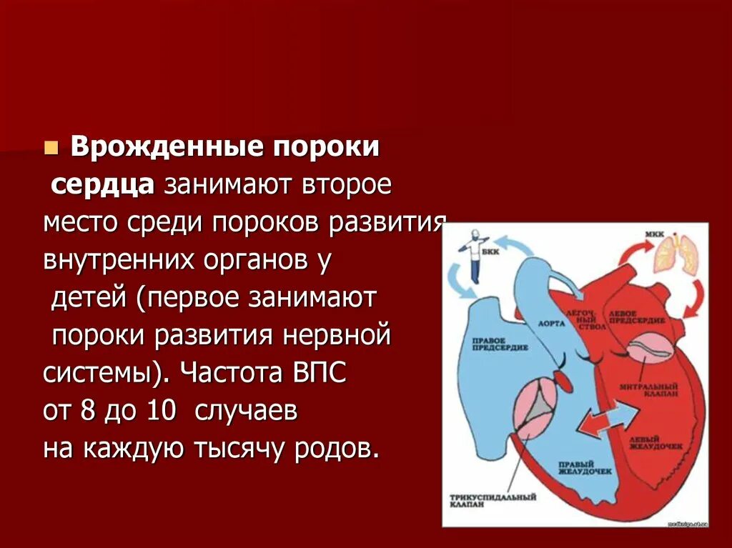 Частота развития врожденных пороков сердца. Врождённые пороки ердца. Парожденные пороки сердца. Врожденныепопроки сердца.