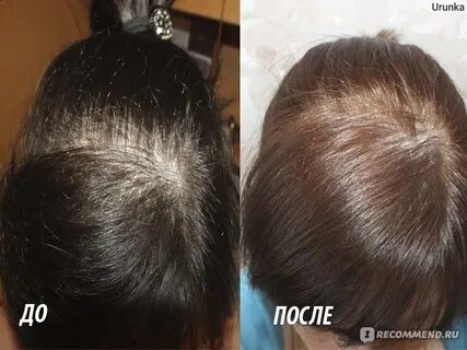 Смывка для волос аскорбиновой кислотой