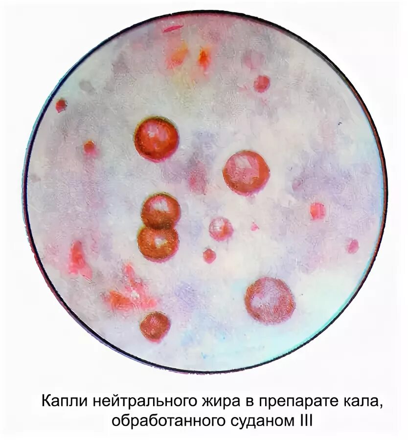Капли жира под микроскопом Мифы и правда о вашем жире: Вот как все на самом деле! Диетолог Николай Тихенко