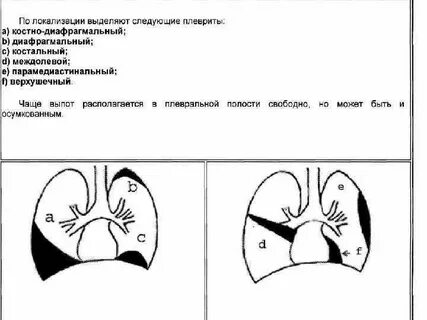 Тест плевриты