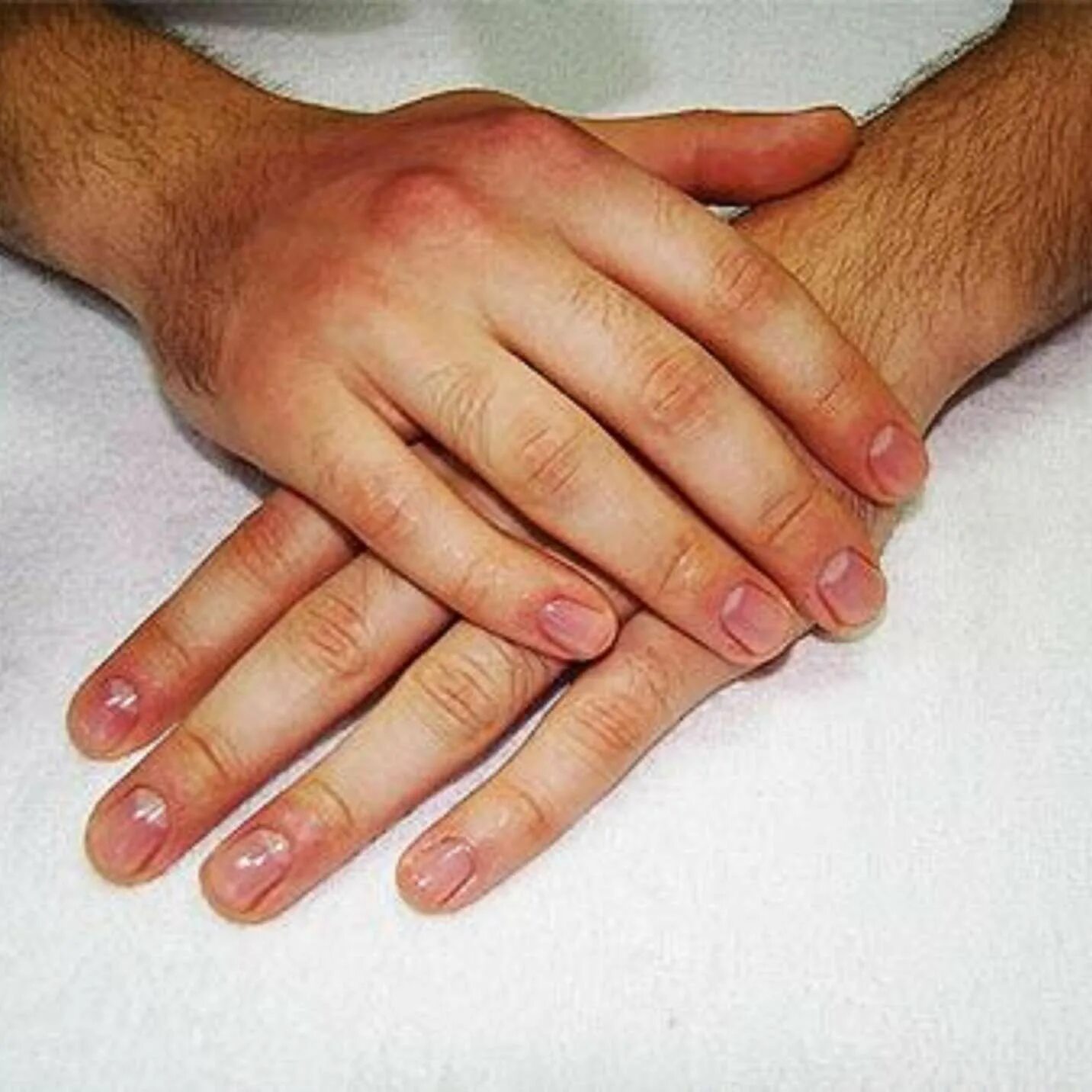 Безымянный палец длиннее мужчины. Мужской маникюр. Мужские пальцы. Мужские ногти. Красивые ногти у мужчин.
