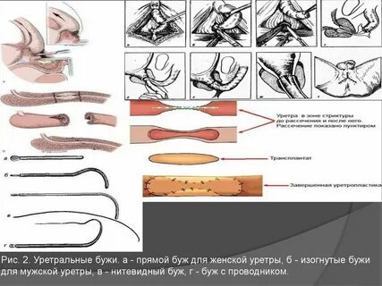Можно вводить в уретру