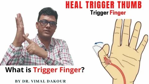 Trigger test