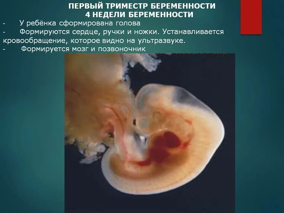 Плод на 4 неделе беременности от зачатия. Развитие зародыша 4 неделя. Как выглядит зародыш на 4 неделе. Эмбрион выглядит 4 недели. Что будет через 4 недели