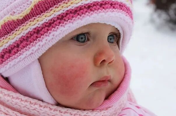 Румяные щеки на морозе. Румяный малыш. Дети зимой. Румяный малыш. Красные щеки от мороза.