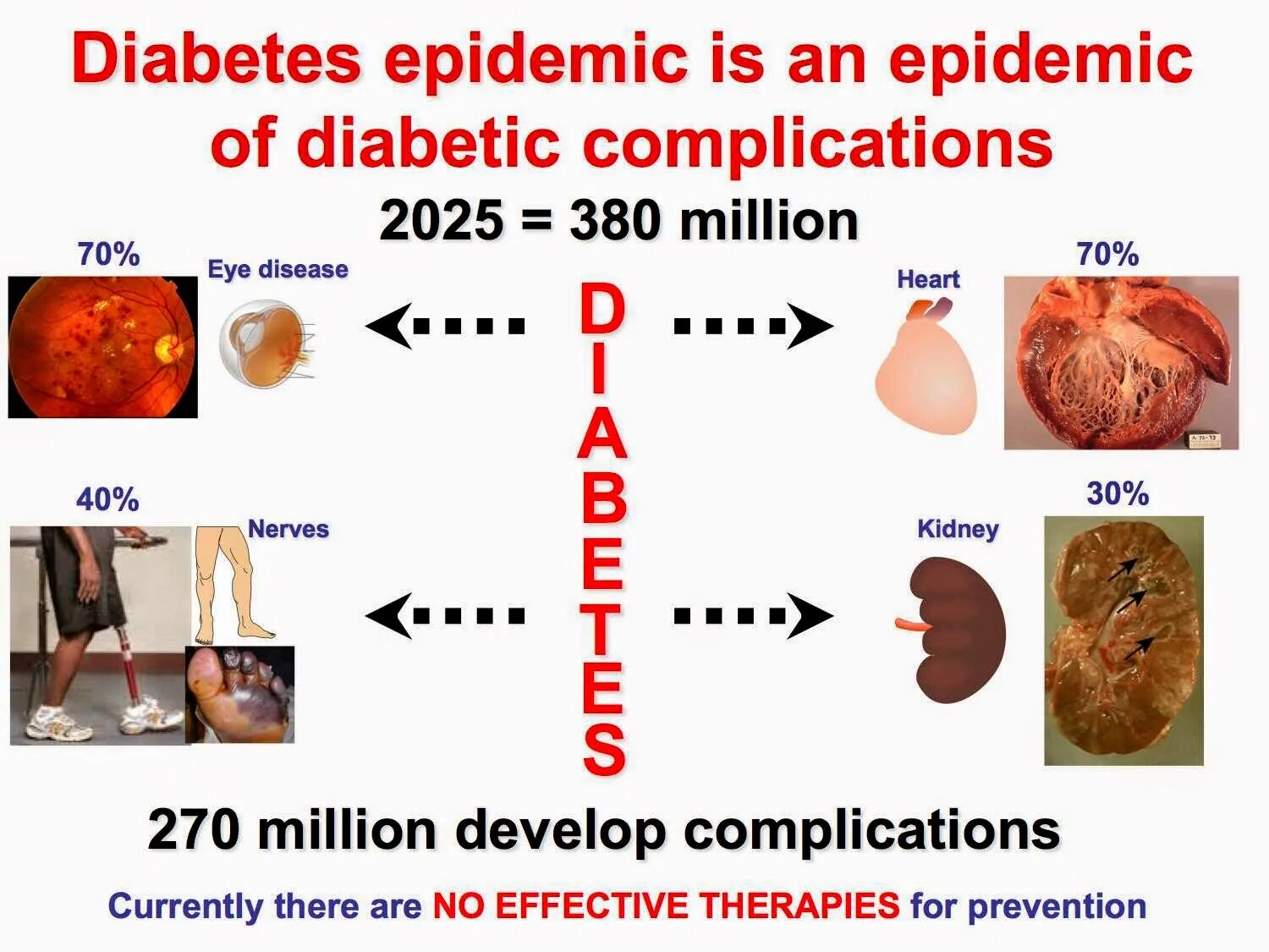 Diabet 1 and 2 Type. The Diabetes Epidemic 2023. Diabetes mellitus Type 1 and Type 2 picture. Регистр сахарного диабета 2024