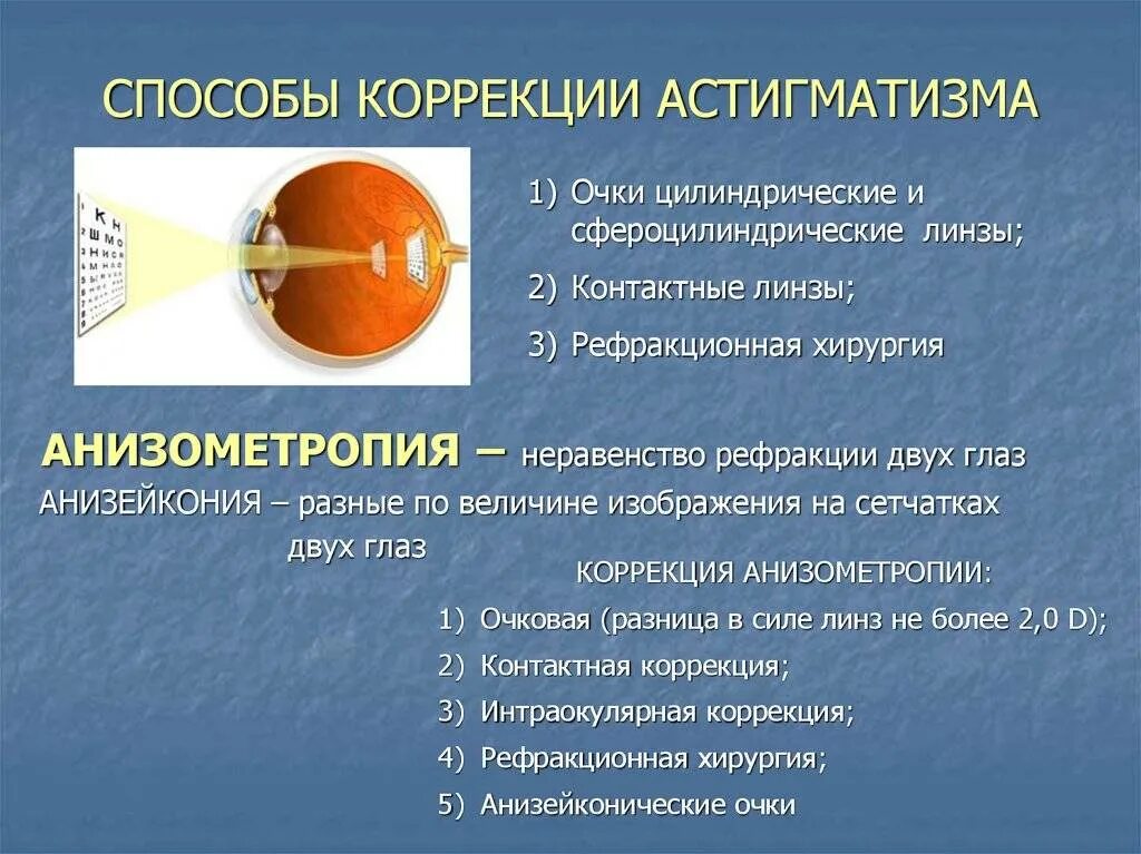 Анизометропия это в офтальмологии. Анизометропия и астигматизм. Методы коррекции астигматизма. Способы коррекции астигматизма. Методы коррекции сигматизма.