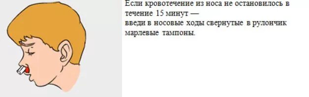 Сильное кровотечение из носа. Кровь из носа давление. Не останавливается кровь из носа у взрослого