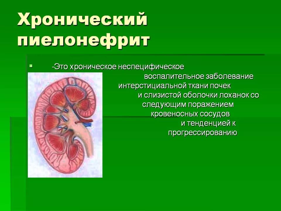 Заболевание пиелонефрит симптомы. Болезнь почек пиелонефрит. Хронический полиенифрит почек. Хронический пиелонефрит. Хроничечки йпиелонефрит.