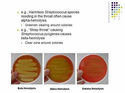 Объясните значение тэ и производящих основ haemolysis