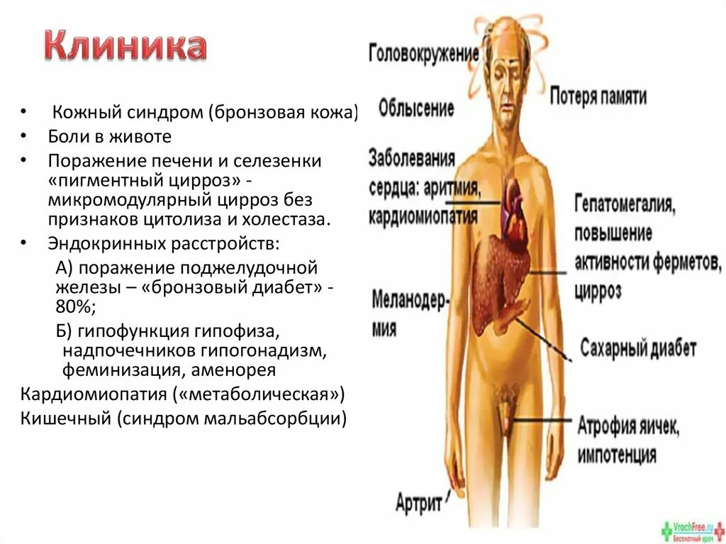 Гепатомегалия печени и поджелудочной железы что это. Гепатомегалия диффузные изменения. Гепатомегалия диффузные изменения поджелудочной железы. Гепатомегалии диффузных изменений печени. Гепатомегалия классификация.