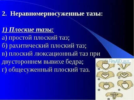 Плоский таз размеры