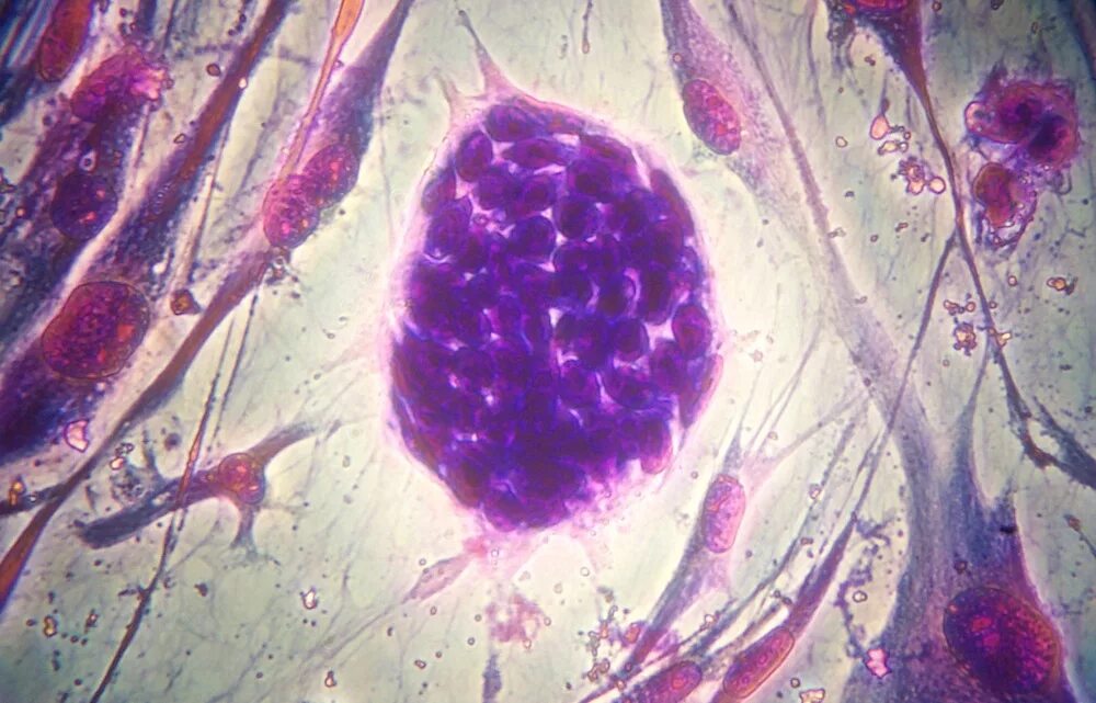 1 стволовые клетки. Гемопоэтическая стволовая клетка гистология. Стволовые клетки гистология. Кроветворные стволовые клетки под микроскопом. Фетальные стволовые клетки под микроскопом.