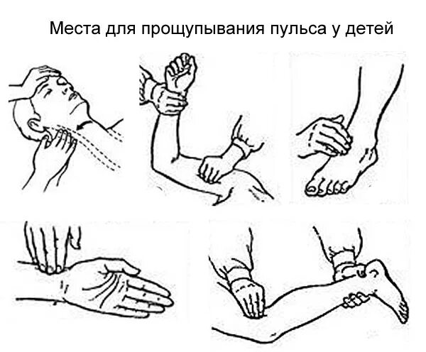 Подсчет пульса у детей. Измерение частоты сердечных сокращений у детей. Измерение пульса у детей алгоритм. Измерение частоты пульса алгоритм. Места измерения пульса у детей.