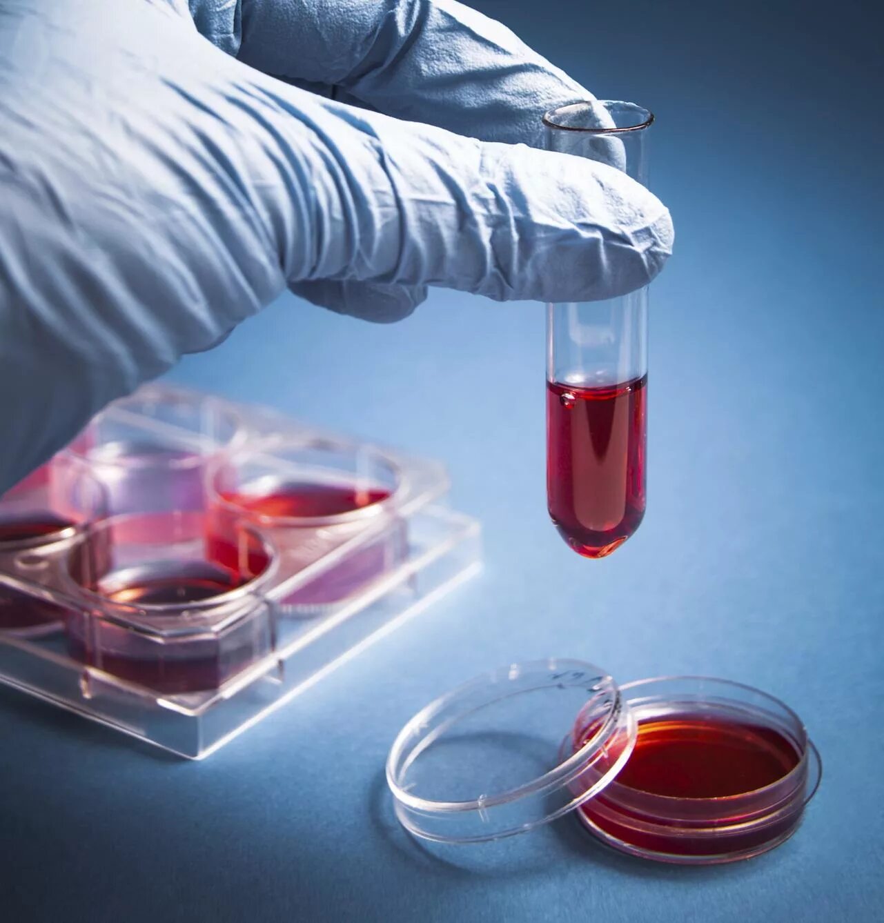 8 лабораторная диагностика. Направления лабораторной диагностики. Лабораторные исследования крови. Диагностическая лаборатория инфекционной. Лабораторная диагностика фото.