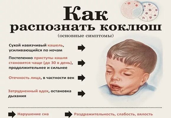 Сильный кашель без температуры ночью. Сухой кашель у ребенка ночью. Сильный сухой кашель приступы у ребенка. Как успокоить кашель у ребенка.
