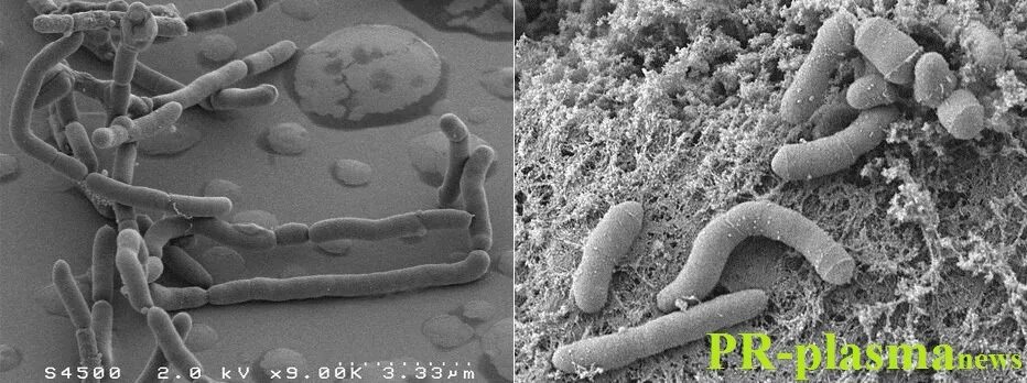 Bacteroides spp что это. Фирмикуты бактерии. бактероиды фрагилис. bacteroides fragilis возбудитель. возбудитель бактероиды микробиология.