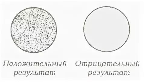 Микропреципитации с кардиолипиновым антигеном