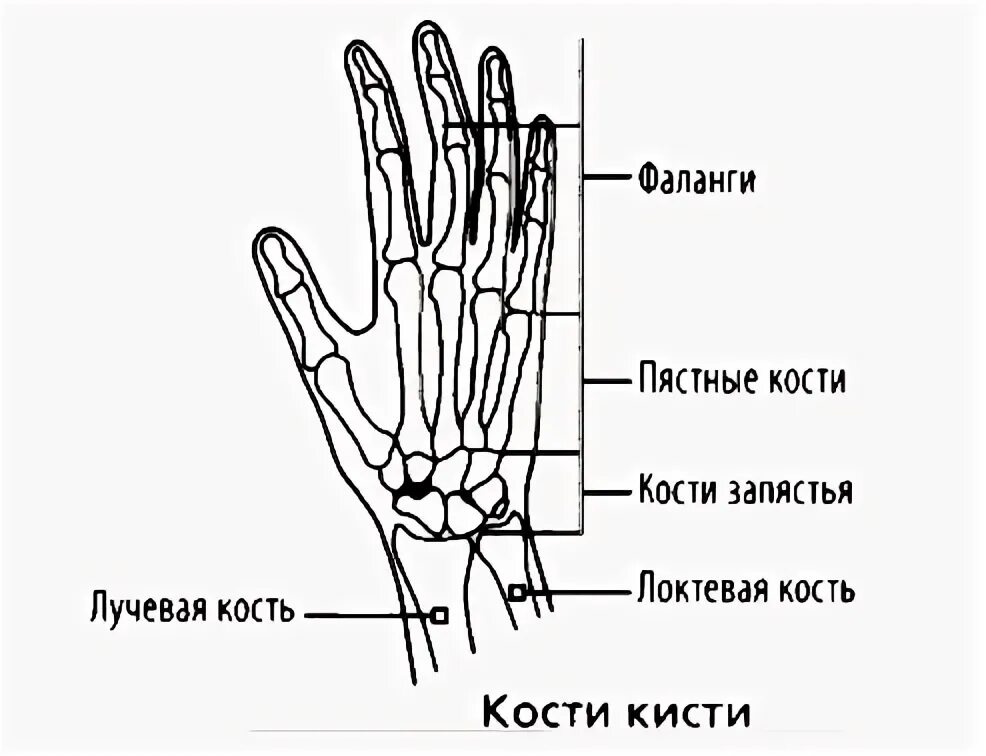 Перелом основания 1 пястной кости. Ossa manus анатомия. Перелом 4 пястной кости рентген. Суставы 1 пальца кисти анатомия. 3 пястная кость.