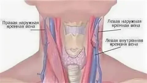 Эктазия правой вены