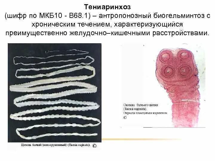 Может ли человек заразиться бычьим цепнем. Тениаринхоз бычий цепень. Тениоз (свиной цепень), тениаринхоз (бычий цепень)..