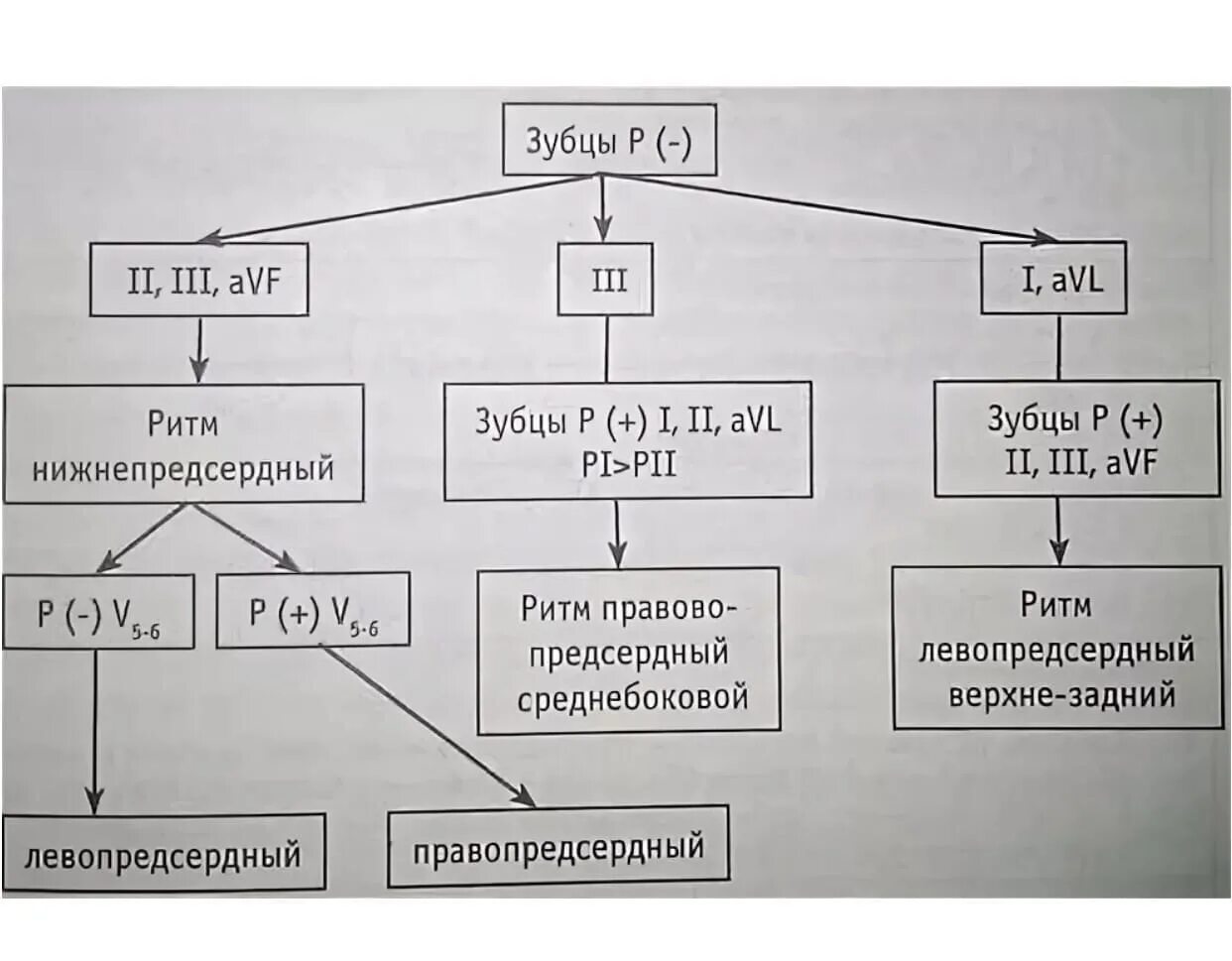 Правопредсердный ритм на ЭКГ. Эктопический правопредсердный ритм. Нижнепредсерлгыц ритм на ЭКГ. Правопредсердный ритм ускоренный. Эктопический предсердный ритм что это