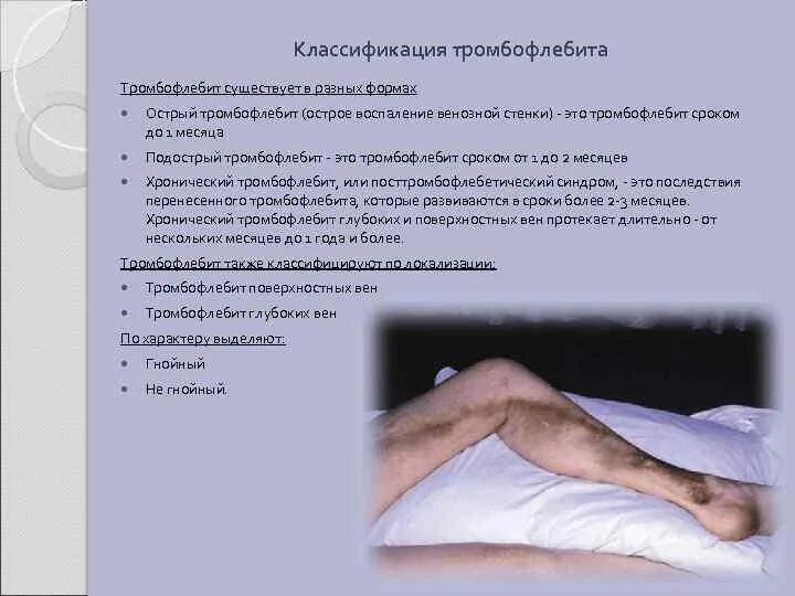 Тромбофлебит карта вызова скорой помощи. Тромбофлебит классификация. классификация венозных тромбозов. тромбофлебит нижних конечностей классификация. поверхностный тромбофлебит классификация.