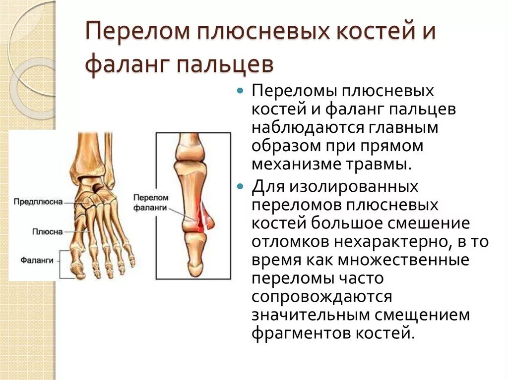 Фаланги пальца тип соединения. Перелом кости предплюсны стопы. Метаэпифиз плюсневой кости. Предплюсна плюсна фаланги пальцев. Перелом плюснои5 кости.