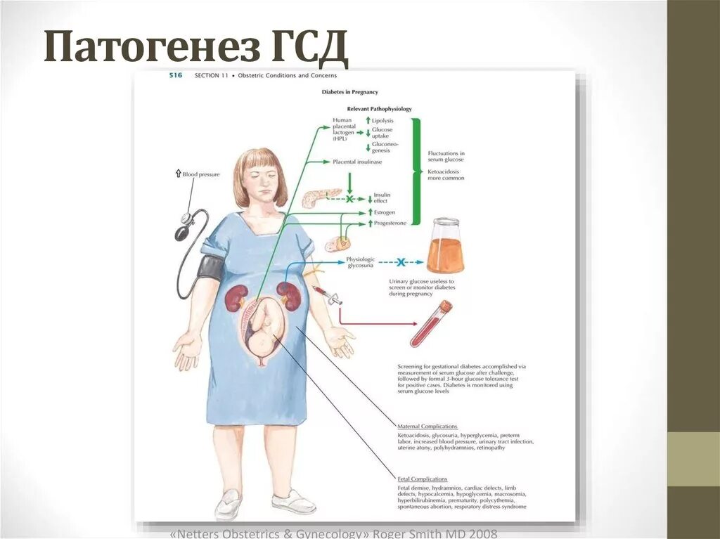 Диабет при беременности последствия. Механизмы развития гестационного сахарного диабета. Патогенез гестационного сахарного диабета. Гестационный сахарный диабет клиника. Гестационный сахарный диабет при беременности патогенез.