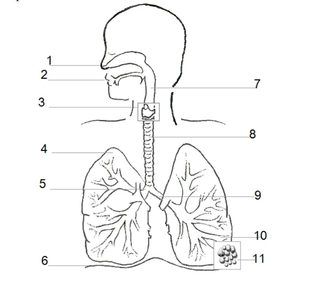 Label the diagram