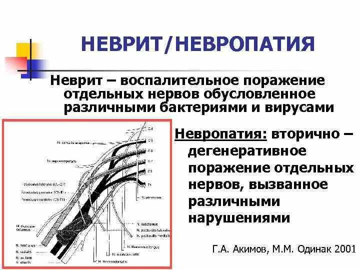 Невропатия нижних конечностей лечение. Невропатия периферических нервов. Симптомы поражения отдельных периферических нервов. Неврит периферических нервов конечностей.