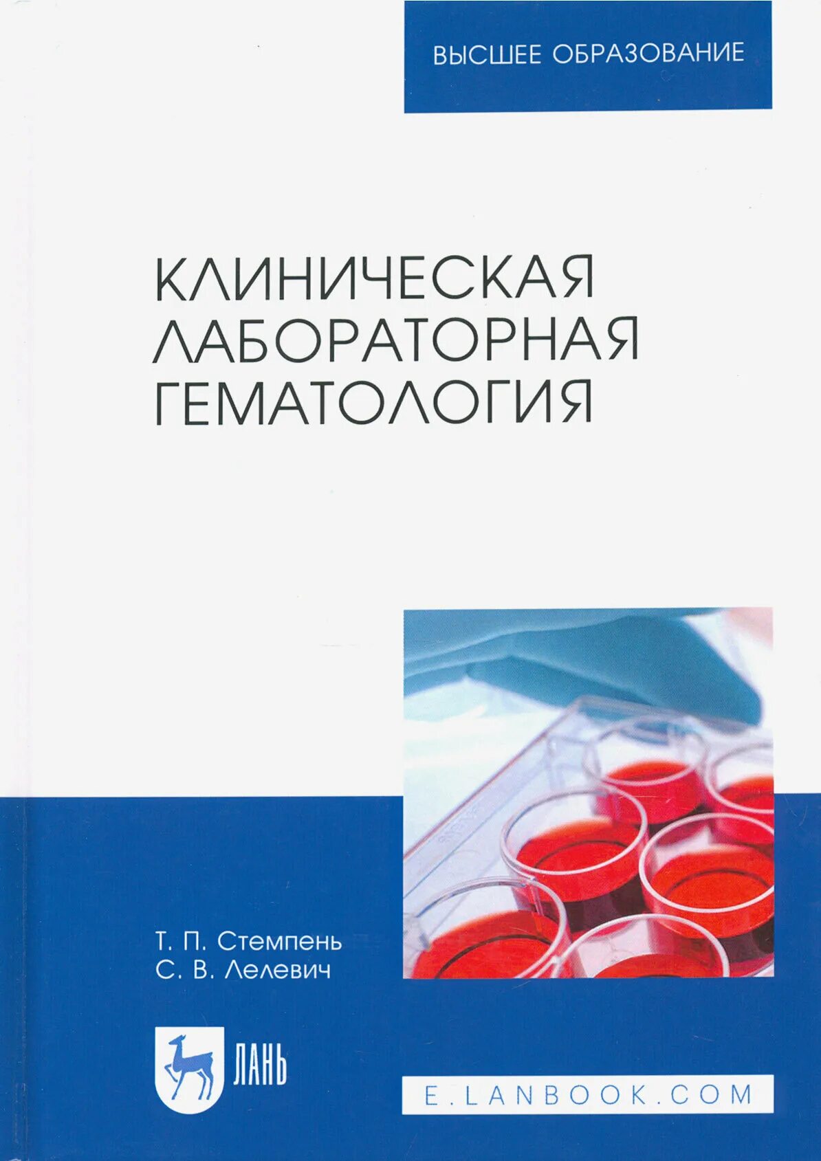 Клиническая лабораторная гематология. Гематологическая лабораторная диагностика. Лабораторная гематология луговская. Клиническая лабораторная гематология. Клиническая гематология.