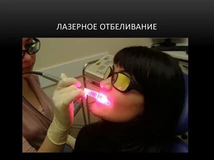 Отбеливание презентация