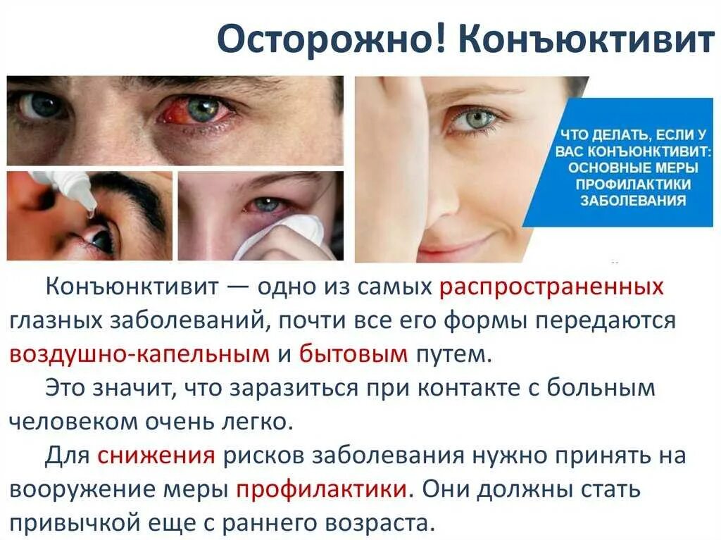 Хронические заболевания зрения. Профилактика конъюнктивита у детей. Профилактика при каньюктивите. Симптомы конъюнктивита глаз. Меры профилактики конъюнктивита у детей.