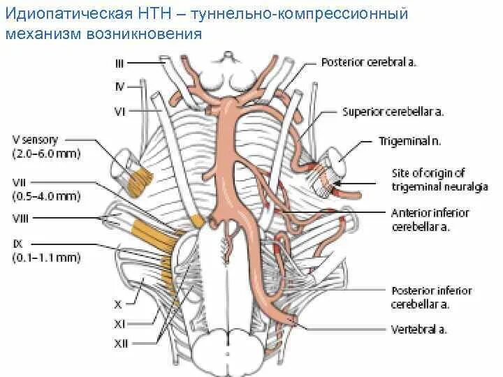 Мрт черепных нервов. Нейроваскулярный конфликт тройничного нерва. Нейроваскулярный конфликт тройничного нерва мрт. Тройничный нерв и мозжечковая артерия. Компрессия корешка тройничного нерва сосудом.