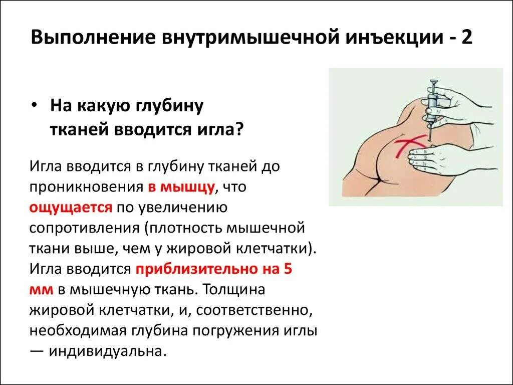 Как правильно колоть железо. Как вводить укол внутримышечно. Глубина введения иглы при проведении внутримышечной инъекции. Как правильно колоть внутримышечные уколы в ягодицу.