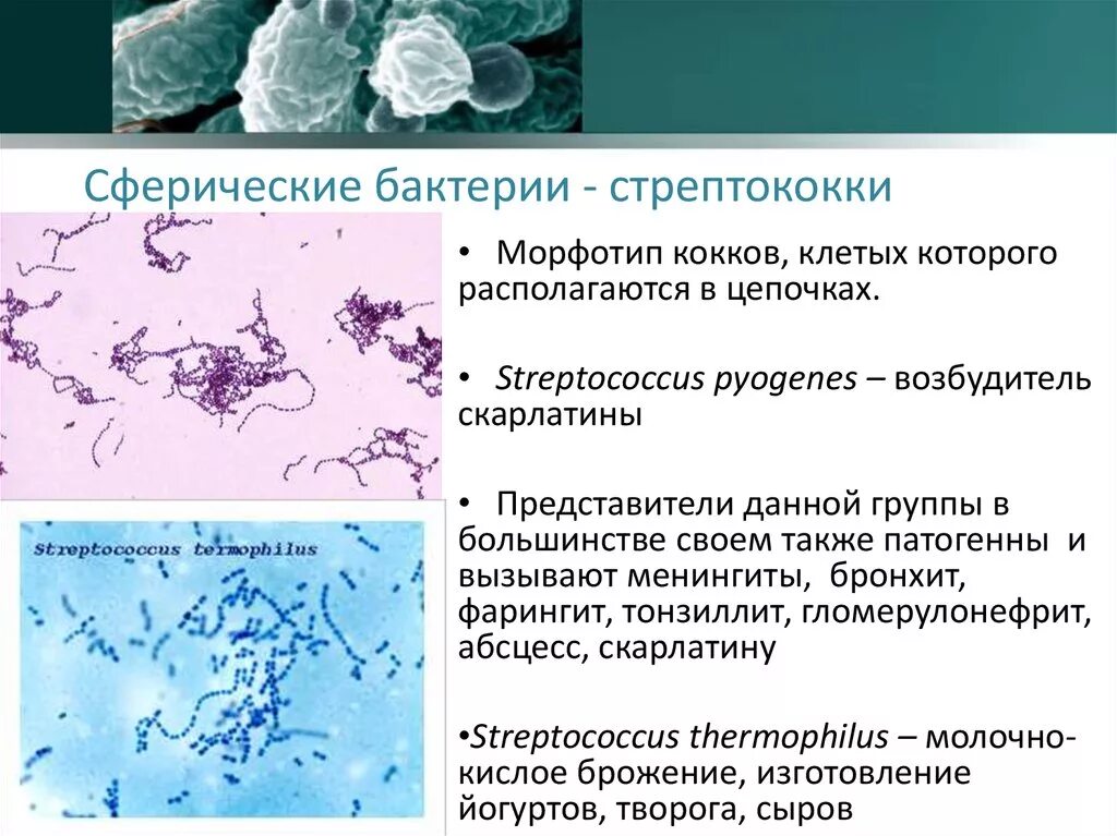 Стрептококки бактерии доклад. Доклад о бактерии стрептококк по биологии. Стрептококки 5 класс биология. Строение бактерии стрептококка.