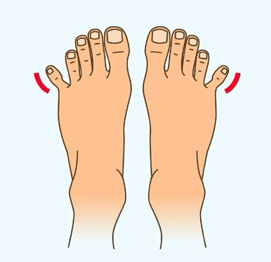 Форма стопы. Пальцы на ногах форма. Форма пальцев стопы. Правильная форма пальцев на ногах. 3 типа стопы