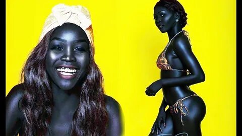 Ньяким Гатвеч – удивительная девушка с уникальным угольным цветом кожи. 