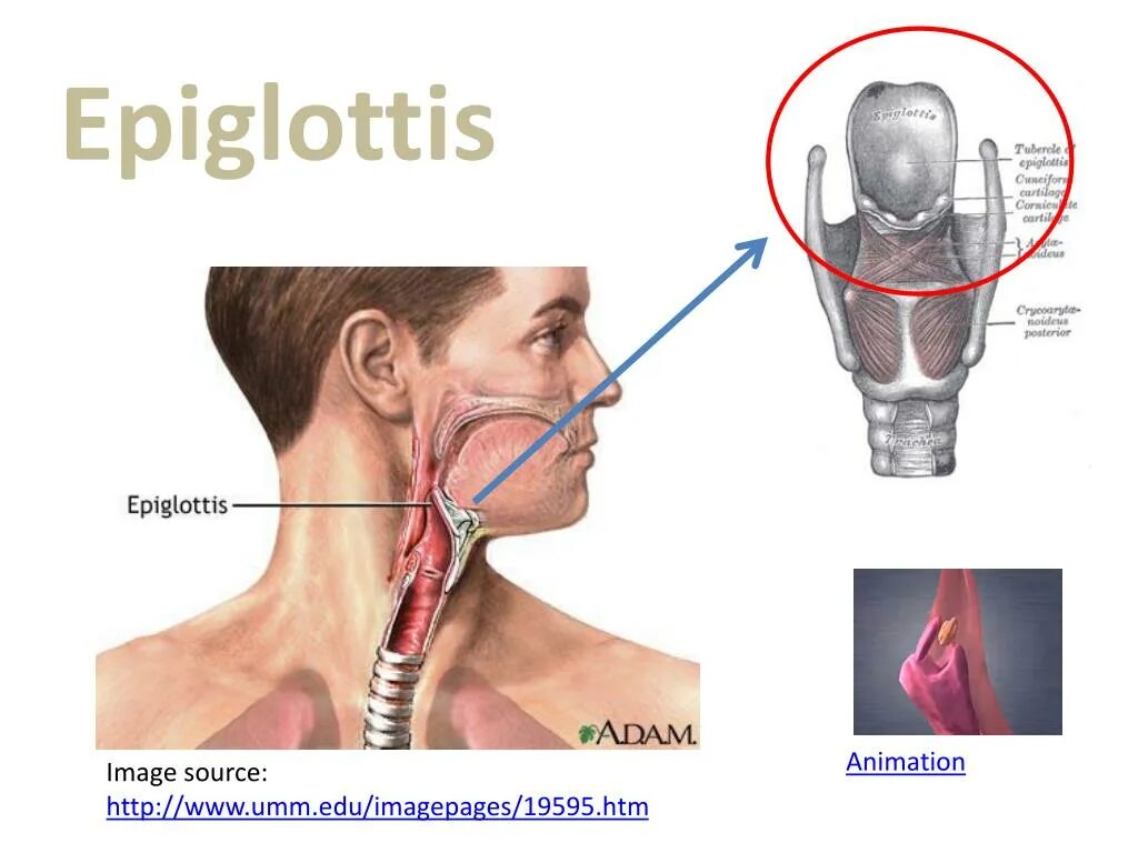 Эпиглоттит симптомы. Эпиглоттит надгортанник.